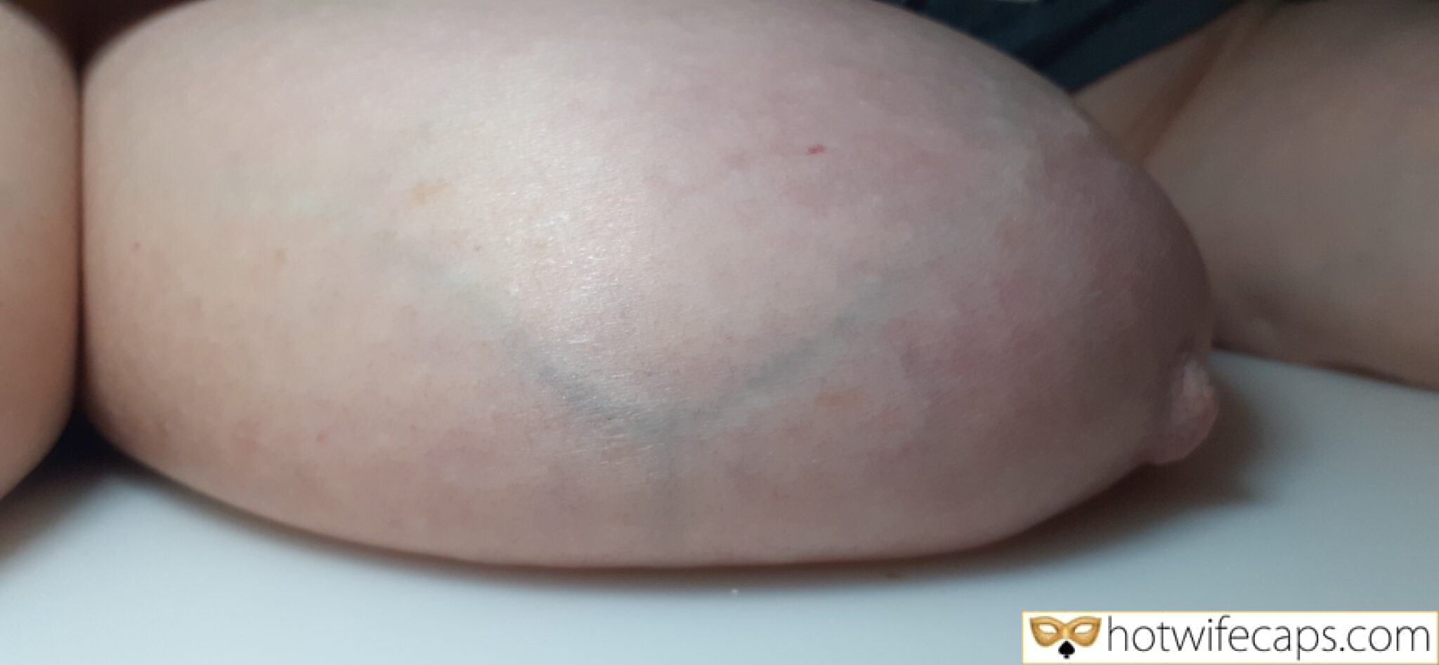 Wife Sharing Flashing Anal hotwife caption: The arm, flexed at the elbow, rests on a cloth-covered surface, its skin marred by blue and red patches. These marks, a silent testament to a night of passion and power, tell a story of submission and dominance. The discoloration,...