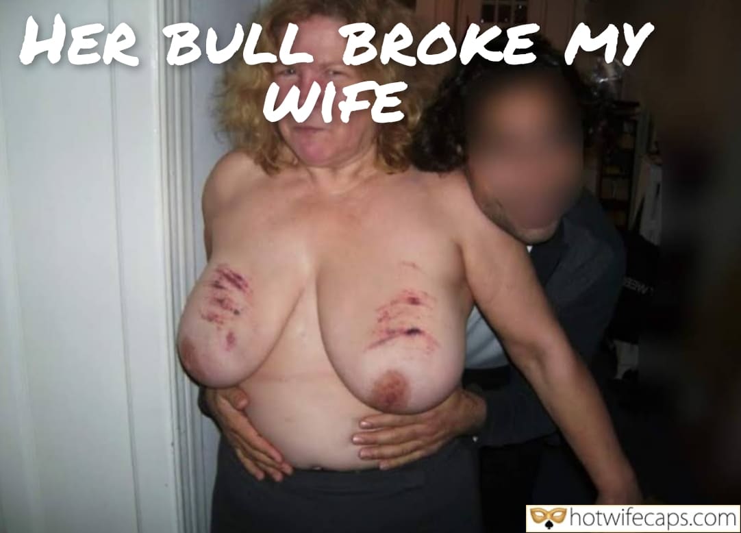 Wife Sharing Submitted by Users 🔥 Cuckold Stories Bull hotwife caption: A cuckold reflects on his wife's injuries from her bull's intense encounter, highlighting the power dynamics and physical marks left on her body. Her Bull’s Brutal Mark: A Cuckold’s Reality